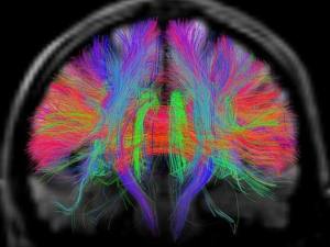 c7795592-66b6-11e5-ba5a-ab3e662cdc07